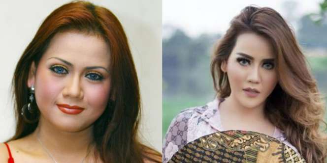 Penampilan Nita Thalia Sehabis Oplas, Beda Banget!