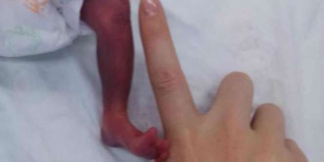 Kenalkan Xiaomi, Bayi Paling Ringan di Dunia 