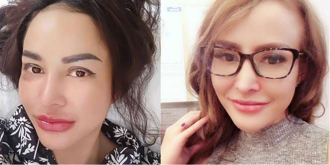 Begini Penampilan Cynthiara Alona Saat Filler Bibirnya Memudar