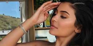 Kontroversi di Balik Pose 'Migrain' Model Cantik Dunia