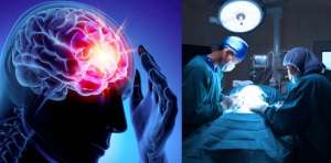 Menderita Epilepsi Akut, Setelah Diperiksa Sungguh Mengejutkan