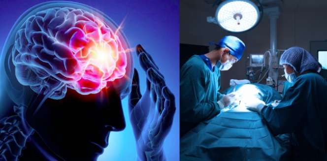 Menderita Epilepsi Akut, Setelah Diperiksa Sungguh Mengejutkan