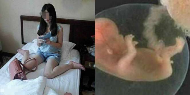 Berhubungan Intim Dengan Banyak Pria, Dokter Kaget Saat Bayinya Lahir