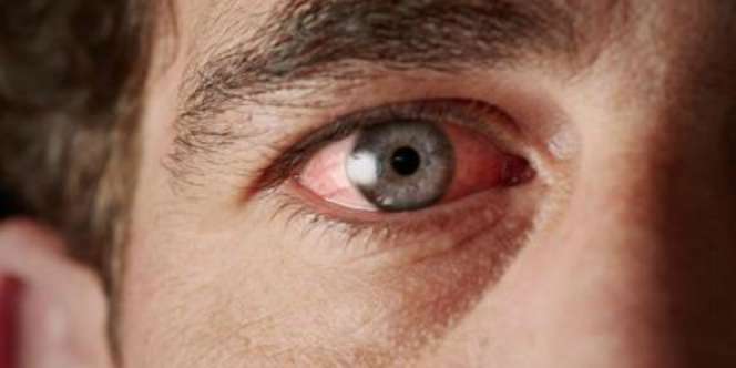 Bahaya Akses Cepat Internet Bagi Kesehatan