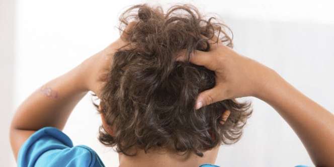 9 Cara Menghilangkan Kutu Rambut dan Telur Kutu Secara Alami dan Permanen