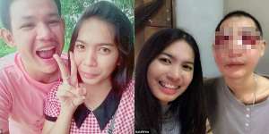 Wanita Ini Buktikan Cinta Sejati untuk Kekasih yang Idap Kanker
