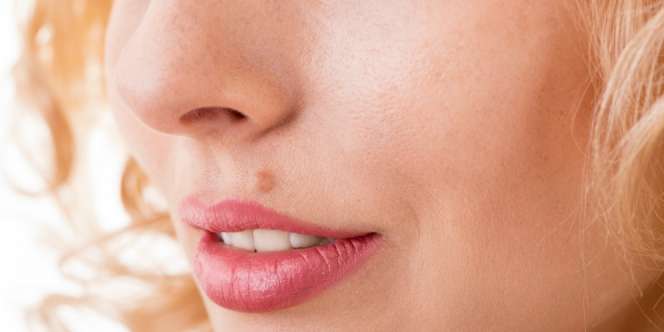 7 Posisi Tahi Lalat Ini Tunjukan Kondisi Keuangan Kamu