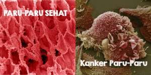 Kumpulan Organ Tubuh Jika Dilihat Pakai Mikroskop