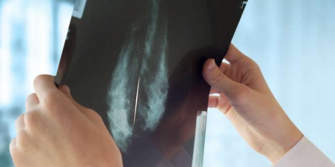 Ladies, Jangan Lupa Lakukan Mammografi Masuki Usia 40