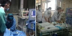 Nyawa Anak Selamat Setelah 30 Staf RS Bergantian Beri CPR Selama 5 Jam