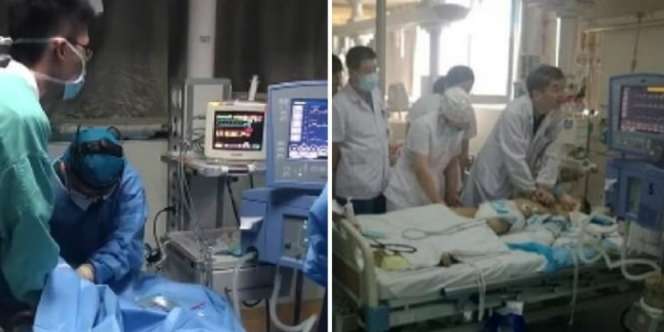 Nyawa Anak Selamat Setelah 30 Staf RS Bergantian Beri CPR Selama 5 Jam