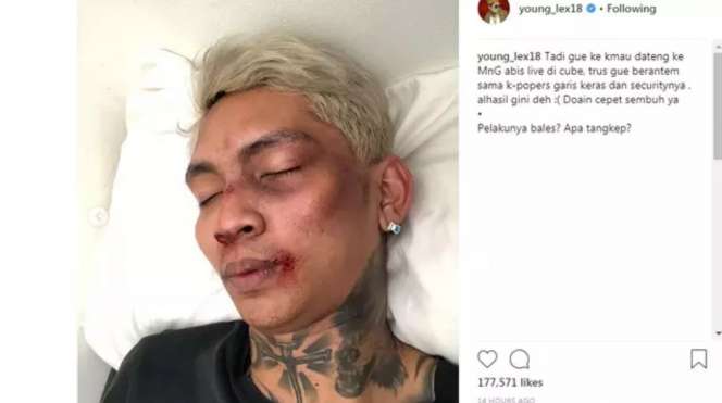 Persamaan Young Lex, Setya Novanto, dan Ratna Sarumpaet