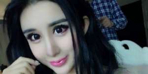 Jenis Operasi Plastik yang Paling Diminati, Mulai Rhinoplasty Hingga Organ Intim