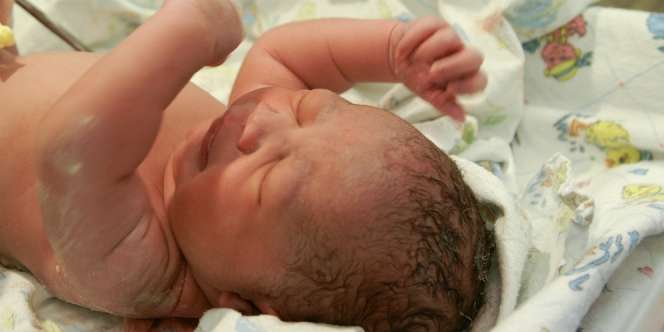 4 Kondisi yang Harus Dihadapi Bayi Prematur