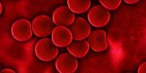 Cara Menaikkan Trombosit Secara Alami dan Cepat Tanpa Obat