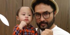Putra Surya Saputra Alami Gangguan Mata Serius