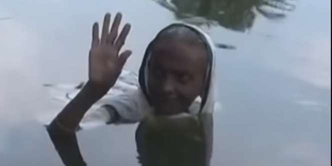 Sudah 20 Tahun, Nenek 'Duyung' Harus Berendam di Danau karena Penyakit Langka