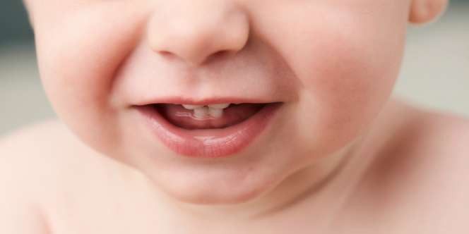 Bercak Putih Pada Mulut Bayi Bisa Jadi Masalah Serius