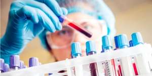 Sterilisasi Alat Medis Bermasalah, 3.778 Pasien Diminta Tes HIV