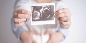 Lagi Tren 'Pregnancy Contract' Antara Suami Istri, Apa Itu?