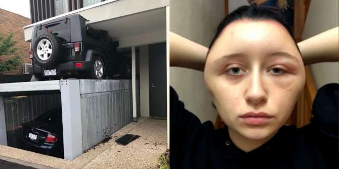 10 Orang Ini Benar-Benar Mengalami Hari Terburuk Mereka