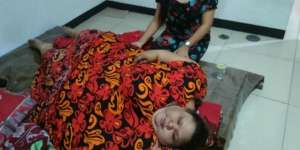 Kondisi Terbaru Wanita 350 Kg Usai Jalani Operasi Pengecilan Lambung