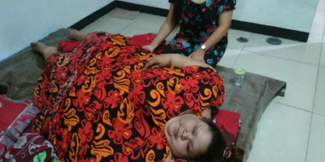 Kondisi Terbaru Wanita 350 Kg Usai Jalani Operasi Pengecilan Lambung