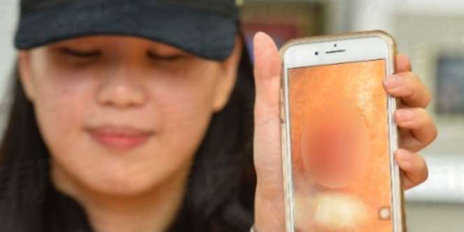 Penyakit `Misterius` Jangkiti Pengunjung Panti Pijat