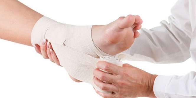 Terkilir Sampai Bengkak, 12 Hari Kemudian Si Wanita Meninggal