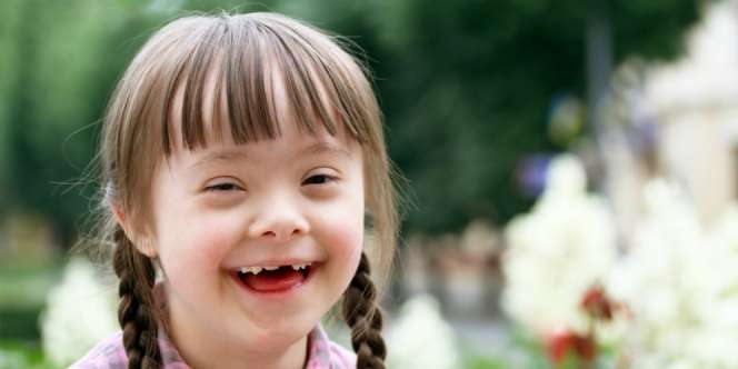 Cara Mengasah Bakat Anak dengan Down Syndrome
