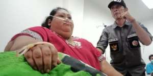 Sunarti, Wanita 148 Kg dari Karawang Meninggal Dunia