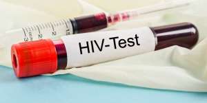 Pria London Diklaim Berhasil Dibersihkan dari Virus HIV