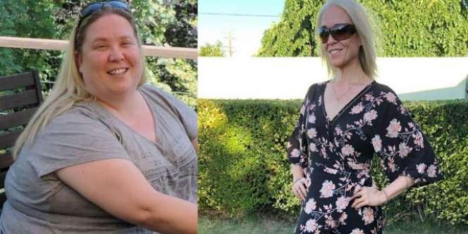 Divonis Dokter Segera Meninggal, Wanita 160 Kg Ini Bikin Keajaiban