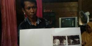 Terjatuh dari Pohon, Bocah 8 Tahun Alami Penyakit Misterius