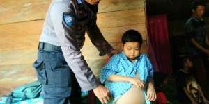 Jatuh dari Pohon, Remaja Ini Idap Penyakit Misterius