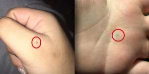 Terungkap Alasan Tanda Hitam Bekas Pensil di Tangan Sulit Hilang