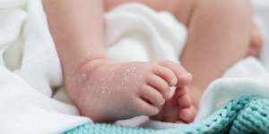 Kulit Kering pada Bayi? Orangtua Wajib Lakukan Ini