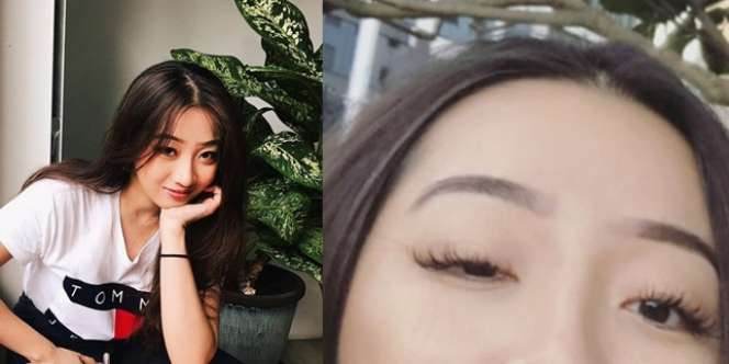 Mata Gadis Cantik Kecil Sebelah Gara-gara Lensa Kontak, Kok?
