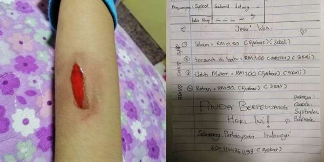 Bermodal Pensil Warna, Bocah 10 Tahun Gambar Luka Seperti Terlihat Nyata
