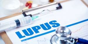 Kenali Gejala Penyakit Lupus yang Banyak Menyerang Wanita