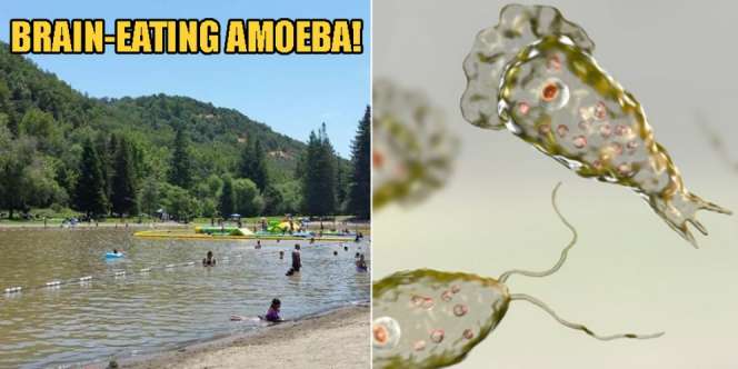 Berenang di Danau Air Tawar, Otak Pria Ini Digerogoti Mahluk Berbahaya