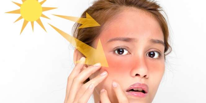 11 Penyebab Kulit Kemerahan di Sekitar Hidung
