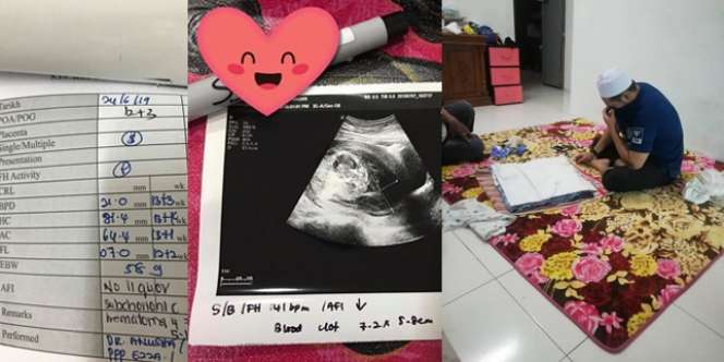 Cerita Ketegaran Wanita Keguguran Sampai Lima Kali Berturut-turut