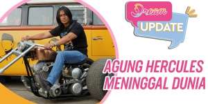 Agung Hercules Meninggal, Ini Perjuangannya Lawan Kanker Otak