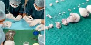 Geger! Dokter Keluarkan 526 Gigi dari Mulut Bocah 7 Tahun