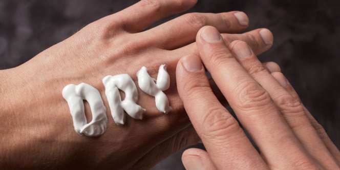 9 Cara Mengatasi Kulit Kering yang Praktis