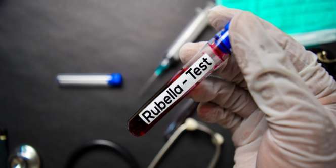 Fakta Penyakit Rubella yang Jarang Kita Tahu