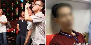 Maksa Nyanyi Nada Tinggi Saat Karaoke, Paru-Paru Pria Ini Jebol