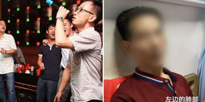 Maksa Nyanyi Nada Tinggi Saat Karaoke, Paru-Paru Pria Ini Jebol