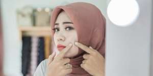 Ketahui Penyebab Jerawat Berdasarkan Area Timbulnya
